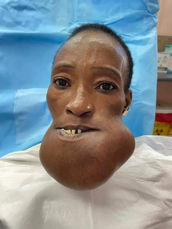 Graphic Content | A woman suffering from a rare condition finds help
